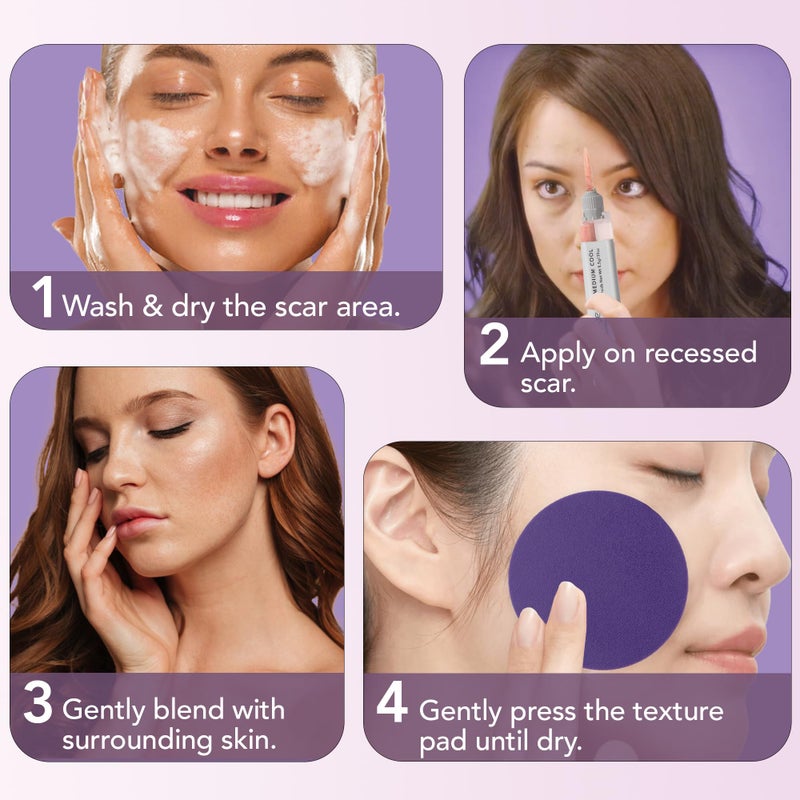 dermaflage مجموعة ملء الندبات ديرمافلاج - متوسطة باردة - تغطية الندبات العميقة وكريم الأساس المقاوم للماء لندبات حب الشباب والتجاعيد وندبات الثلج، إمداد لمدة 1 شهر - Image 4